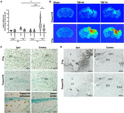 Protein Expression of the Microglial Marker Tmem119 Decreases in Association With Morphological Changes and Location in a Mouse Model of Traumatic Brain Injury